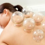 4 Amazing Benefits of Cupping Therapy