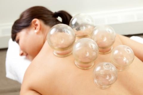 4 Amazing Benefits of Cupping Therapy