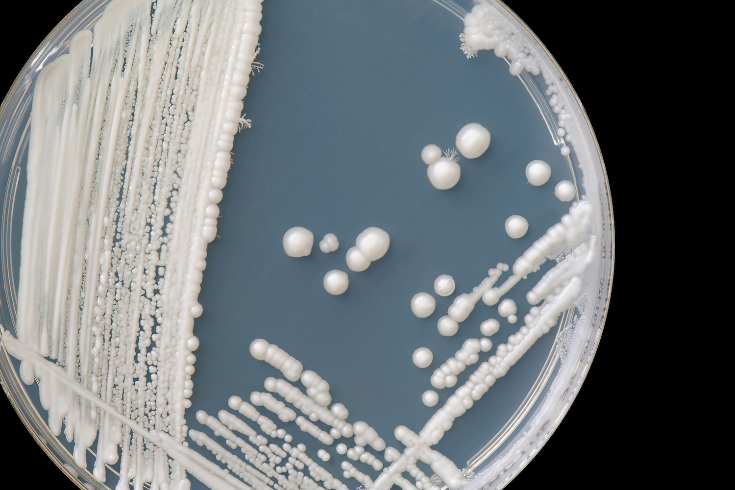 How To Manage Candida, Naturally